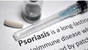 psoriasis autoimmune response